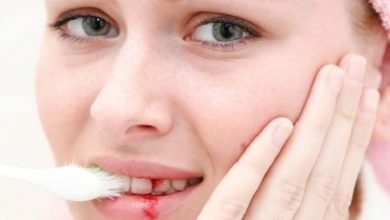 Chảy máu chân răng là bị bệnh gì