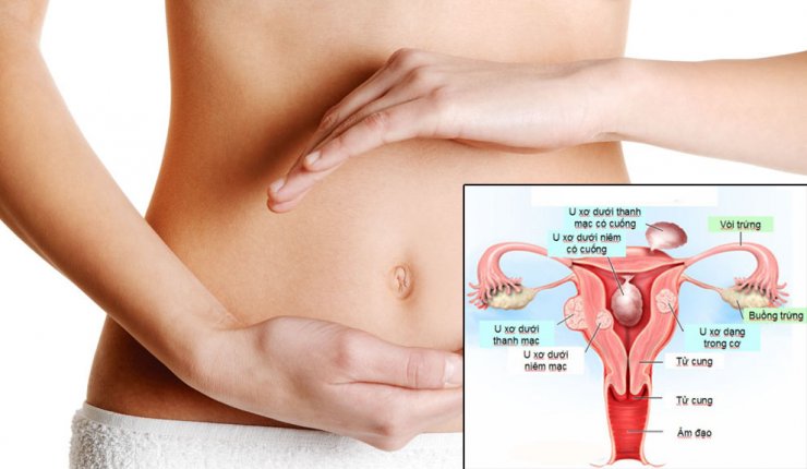 đau bụng dưới âm ỉ là bệnh gì