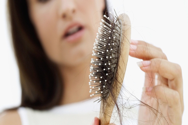 Rụng tóc nhiều ở nữ là bệnh gì